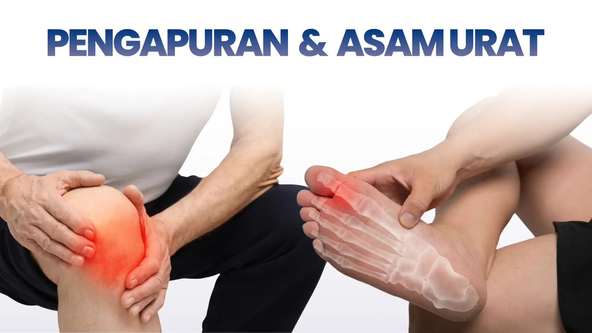 Perbedaan nyeri sendi akibat pengapuran yang sering menyerang lutut dan asam urat yang sering menyerang jempol kaki.